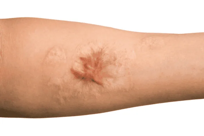The Scars of the Job: Expert Care for Work-Related Injuries and Workers’ Comp